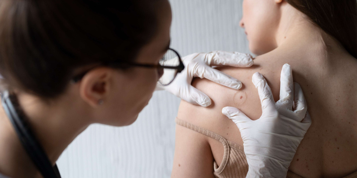Filariasis and Immune System: How the Parasite Affects Your Body