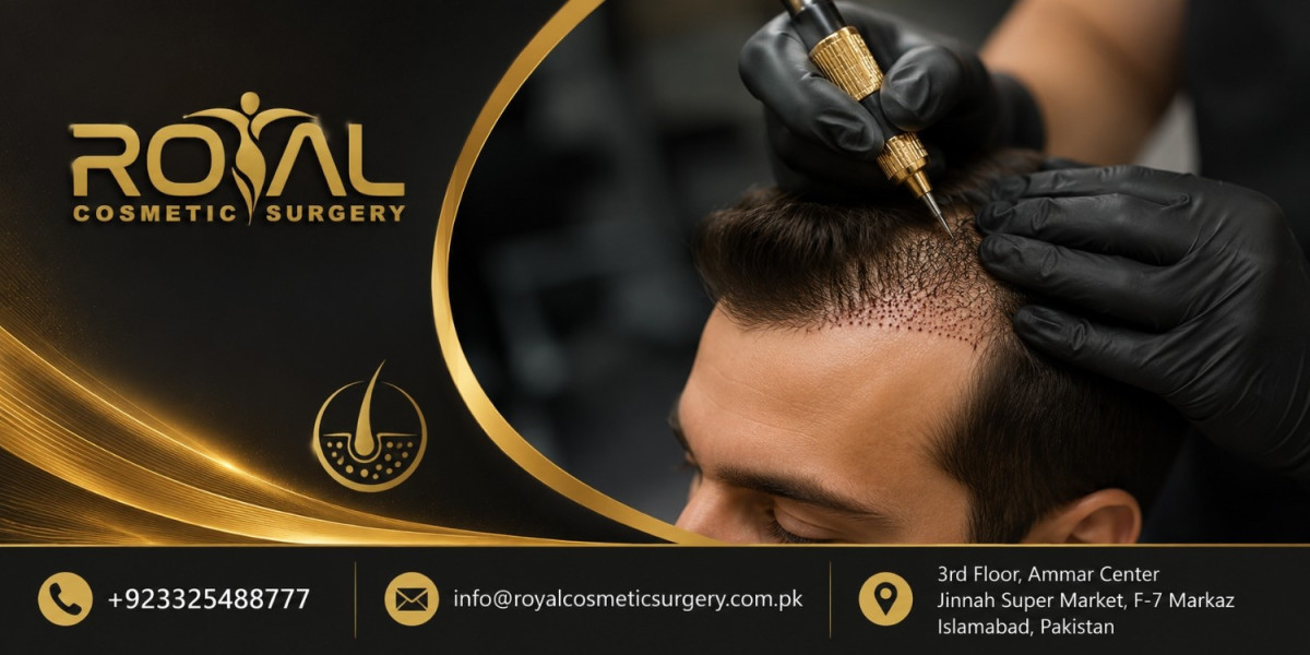 DHI Hair Transplant in Islamabad for Permanent Growth