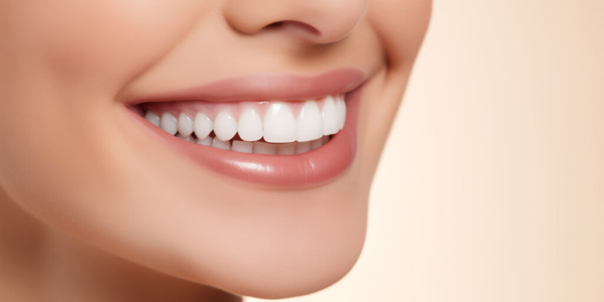 Can a Smile Makeover Give You a More Complete Smile?